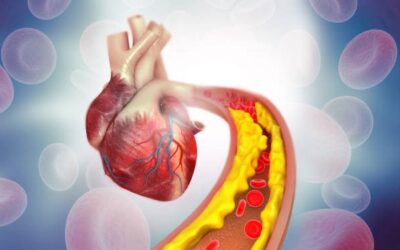 Effectiveness of medical management vs revascularization for intermittent leg claudication